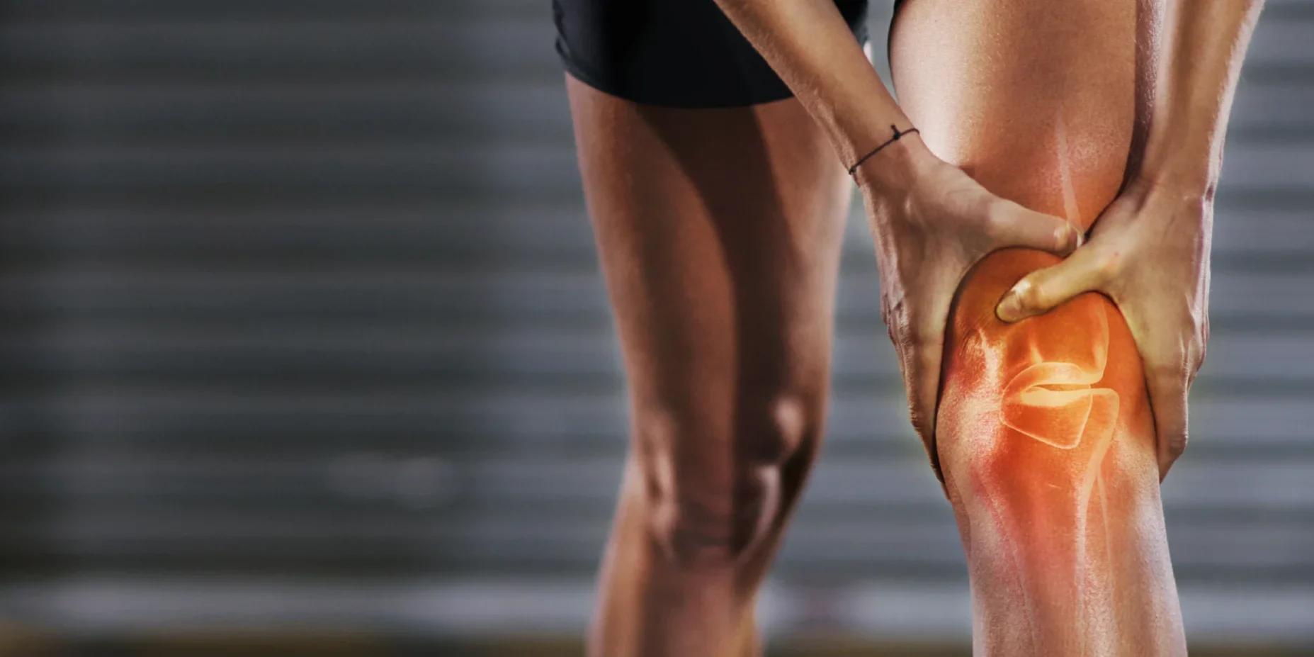 Role of Undenatured Chicken Collagen Type II in Osteoarthritis